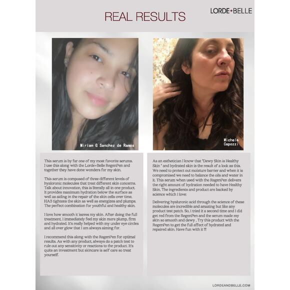 Lorde + Belle HA3 Serum Full Size - Picture 6 of 8